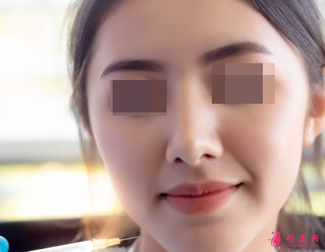 自體脂肪填充面部安不安全