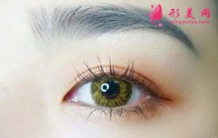 做開(kāi)眼角怎么避免出現(xiàn)明顯疤痕？