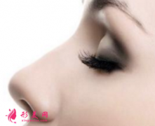 假體隆鼻術(shù)后的護(hù)理事項要注意哪些？
