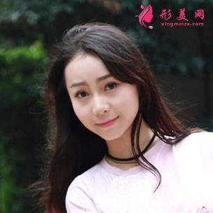 埋線雙眼皮+鼻綜合整形手術(shù)效果圖對(duì)比照