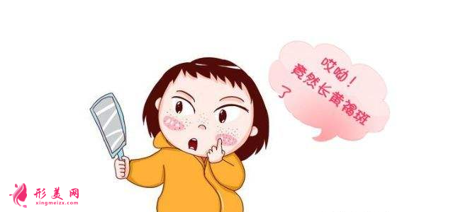 如何去黃褐斑比較有效？