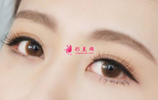 怎么避免雙眼皮手術(shù)的風險