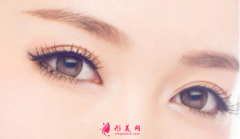 雙眼皮手術(shù)是局麻還是全麻？