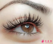 開眼角手術多少錢左右?