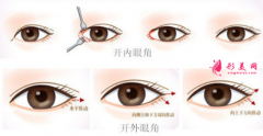 開內(nèi)眼角和開外眼角的區(qū)別？