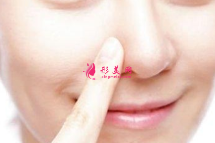 鼻翼縮小手術(shù)一般需要多少錢