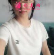 北大何君君隆胸案例反饋！終于擺脫了平胸！