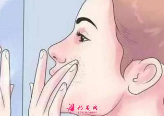 激光祛斑后會有結(jié)痂嗎