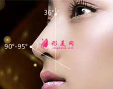 假體隆鼻有什么優(yōu)勢？