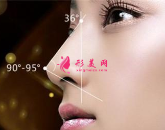 假體隆鼻有什么優(yōu)勢