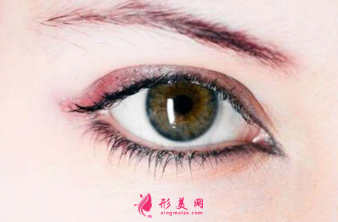開(kāi)眼角后怎么避免疤痕增生