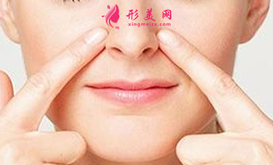 鼻翼縮小手術(shù)適合什么人群