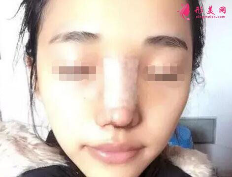煙臺(tái)華怡整形醫(yī)院好么