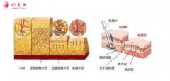 手臂吸脂價格是多少錢？影響價格的因素有哪些？