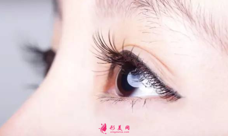雙眼皮手術(shù)前的準(zhǔn)備工作有哪些