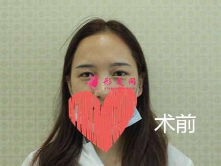 深圳赫思醫(yī)療美容怎么樣？價目表及網(wǎng)紅鼻整形案例