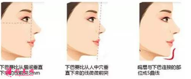 自體脂肪隆下巴效果圖