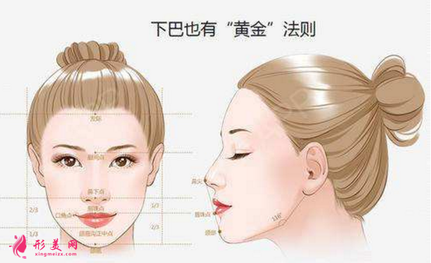 自體脂肪隆下巴效果圖