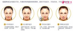 北京面部提升術價格是多少？注意事項你都了解了么？