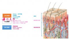 果酸換膚需要多少錢？術后注意事項你都了解嗎？
