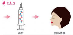 臉部自體脂肪填充價(jià)格是多少？可以維持多久？