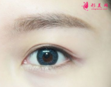 什么不適合做開眼角手術(shù)？