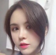 上海薇琳醫(yī)療美容醫(yī)院張懷軍隆鼻案例分享，前后鮮明對(duì)比