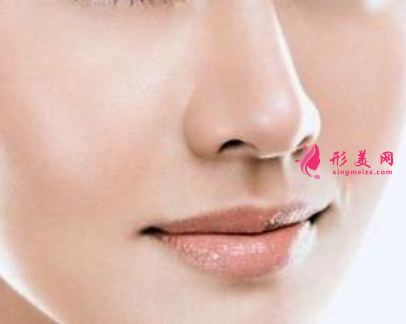 假體隆鼻后鼻尖發(fā)紅怎么回事