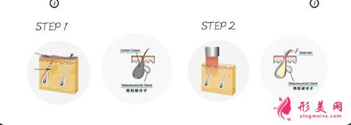 影響黑臉娃娃嫩膚的因素