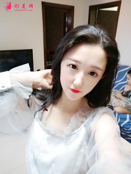 深圳香蜜麗格醫(yī)療美容激光祛斑3個月