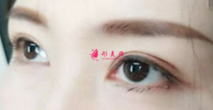 什么樣的雙眼皮比較好看？