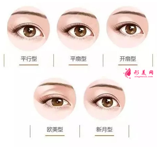 什么樣雙眼皮比較好看