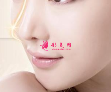 假體隆鼻能維持多久