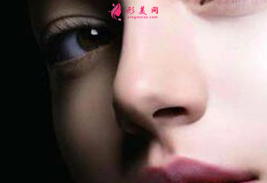 廣州鼻翼縮小的價(jià)格跟什么因素有關(guān)
