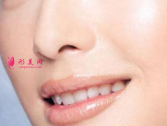 鼻翼縮小的價(jià)格跟什么因素有關(guān)？