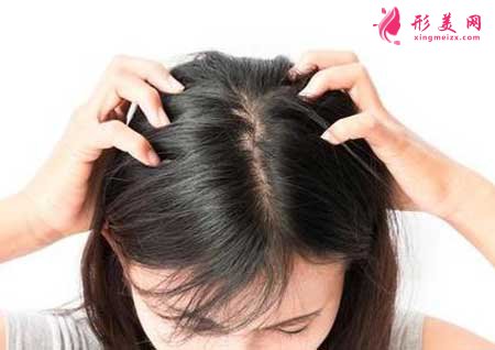 南京哪家醫(yī)院做植發(fā)技術(shù)好?適合哪些人?