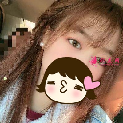 俞翰秀醫(yī)生技術(shù)怎么樣？雙眼皮案例