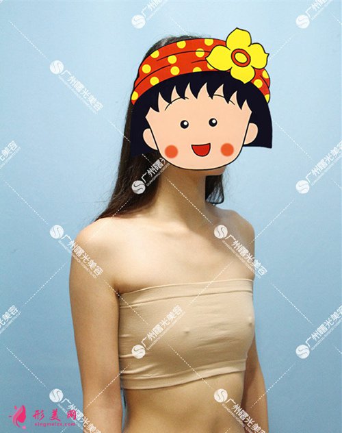 廣州曙光整形醫(yī)院隆胸好不好 廣州曙光整形醫(yī)院隆胸好不好