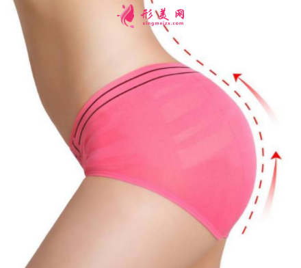 臀部吸脂的風(fēng)險(xiǎn)有哪些