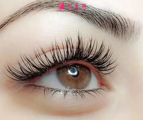 開內(nèi)眼角要多長時間