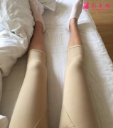 大家看看鄭州悅美整形美容醫(yī)院做的吸脂瘦大腿手術(shù)效果好不好