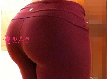 廣州臀部吸脂減肥的價(jià)格是多少