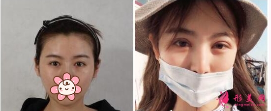 上海九院整形價(jià)格表|坐診醫(yī)生名單、信息大全