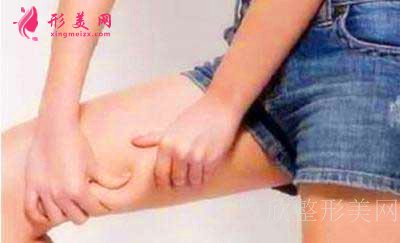 廣州中科美鄧詠科普：夏天最受歡迎的瘦腿針到底是什么呢？