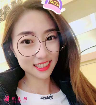 和顏美帕劉喆做白瓷娃娃怎么樣？術(shù)后60天真人案例效果分享~