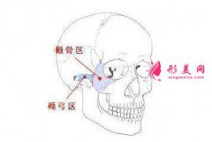 上海整形醫(yī)院顴骨顴弓內(nèi)推手術(shù)有什么風(fēng)險嗎？