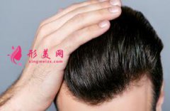 上海整形醫(yī)院種植發(fā)際線多少錢?具體的影響因素都有哪些呢？