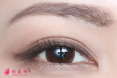 為什么你做的雙眼皮被人一眼看穿？還敢亂去做嗎？