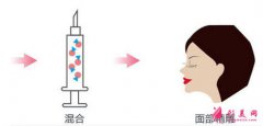上海北京整形醫(yī)院自體脂肪填充安全嗎？多久可以恢復(fù)