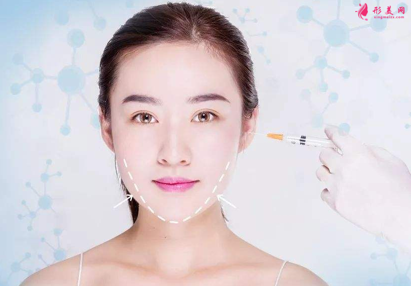打瘦臉針要多少錢？注意事項(xiàng)大全~
